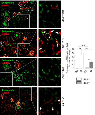 Endothelial Activin Receptor-Like Kinase 1 (ALK1) Regulates Myofibroblast Emergence and Peritubular Capillary Stability in the Early Stages of <mark class="highlighted">Kidney Fibrosis</mark>